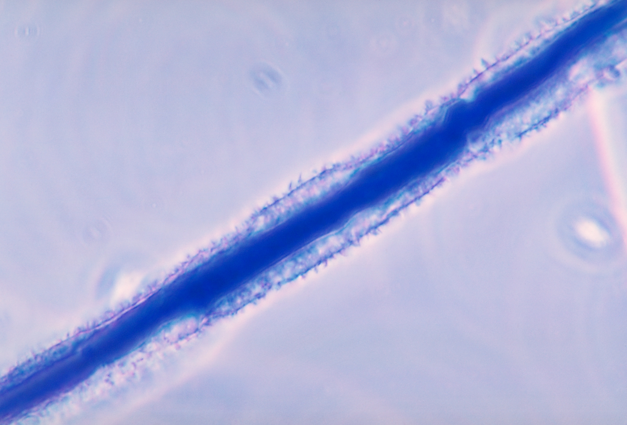 Aspergillus flavus 01.jpg