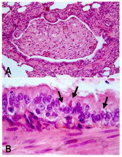 466px-Canine distemper pathology.jpg