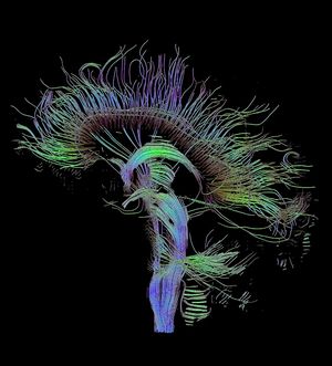 DTI-sagittal-fibers.jpg