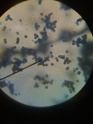 Live aspergillus.jpg