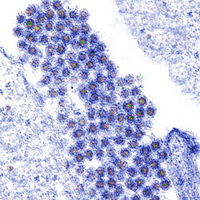 Dengue Virus.jpg