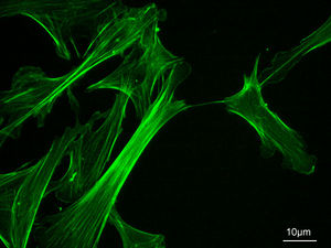 MEF microfilaments.jpg